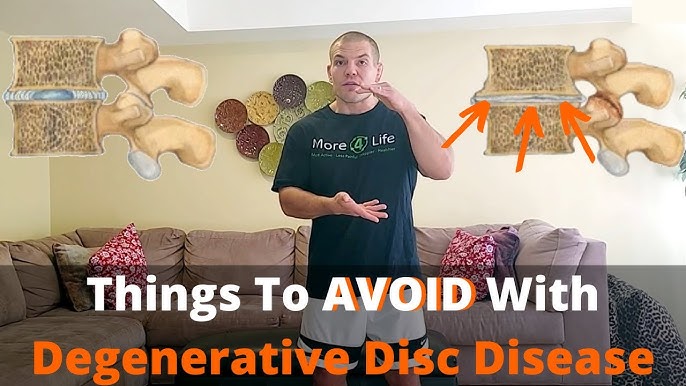 Degenerative Disc Disease - Everything You Need to Know 