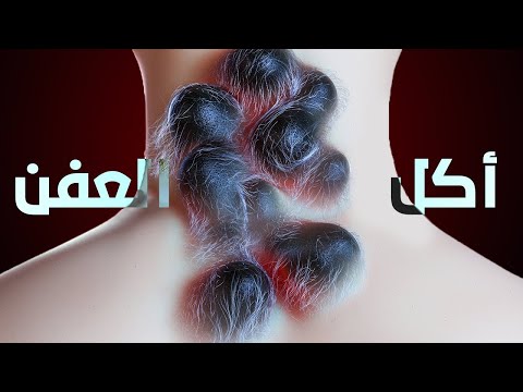 فيديو: هل يقتلك الخبز المتعفن؟