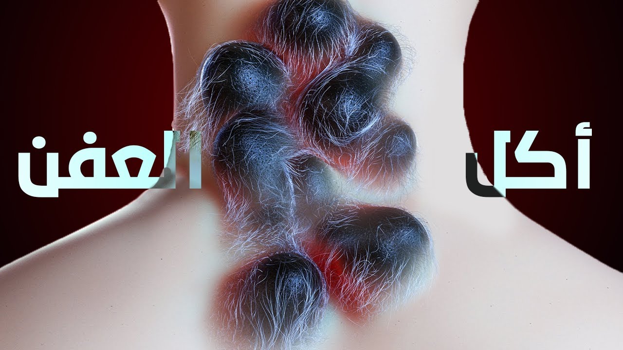 ماذا لو أكلت الخبز المتعفن !!