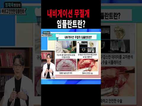 정재욱원장의 <strong>내비게이션</strong> 무절개 임플란트?