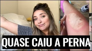 Sólidas congeladas pernas