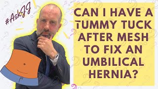 #AskJJ - Can I have a tummy tuck after mesh to fix an umbilical hernia?