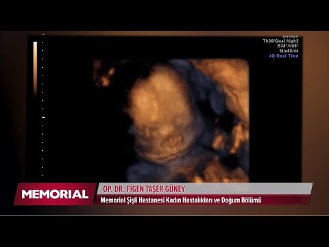 Video: 20 Haftalık Hamilelik: Duyular, Fetal Gelişim