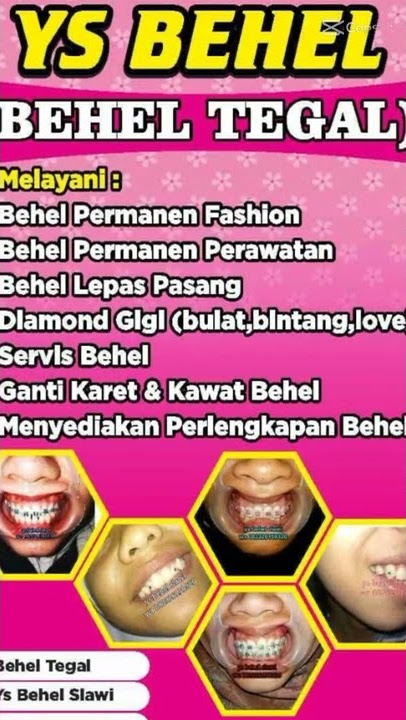 Ys behel - testi DIAMOND GIGI