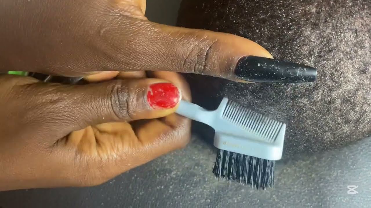 ASMR FAST AND AGGRESSIVE HEAD SCRATCHING OF DANDRUFF INTENSE DANDRUFF REMOVAL ON A BALD HEAD