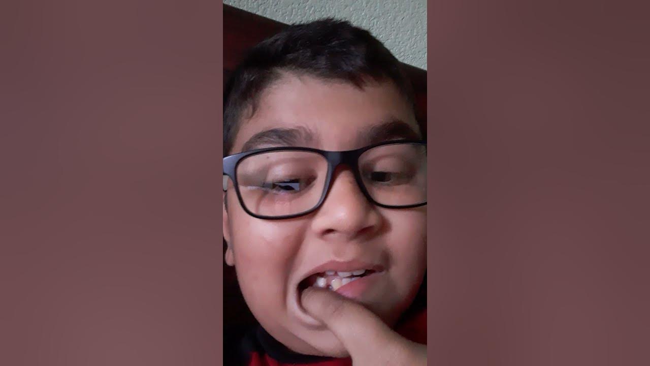 my tooth fell out - YouTube