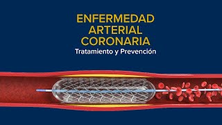 Enfermedad Arterial Coronaria (EAC) - Tratamiento y Prevención