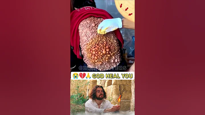 Prayer for Healing & Recovery 😭💔🙏 • #0206