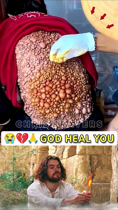 Prayer for Healing & Recovery 😭💔🙏 • #0206