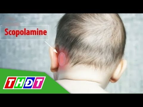 Video Miếng dán say xe có thể gây rối loạn tinh thần trẻ nhỏ... - youtube