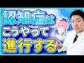 認知症の4つの進行段階をわかりやすく解説！予防を始める最適のタイミングは？
