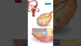 Early Precocious Puberty Tests & Treatment Dr. Abhishek Prakash, Endocrinologist, Jaipur