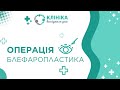 👁️‍🗨️ Кругова блефаропластика — пластична операція на верхніх і нижніх повіках ➤ як робиться в КВД