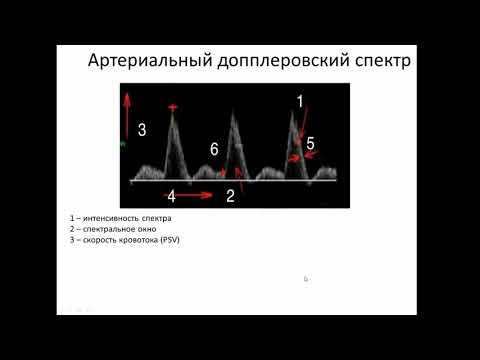 Допплеровская спектральная кривая.Что есть норма?