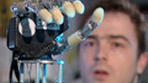 Man Controls Robotic Hand with Mind
