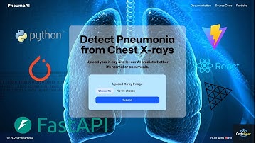 Detect Pneumonia with AI 🔬 | PyTorch + CNN + FastAPI + React Full-Stack Project