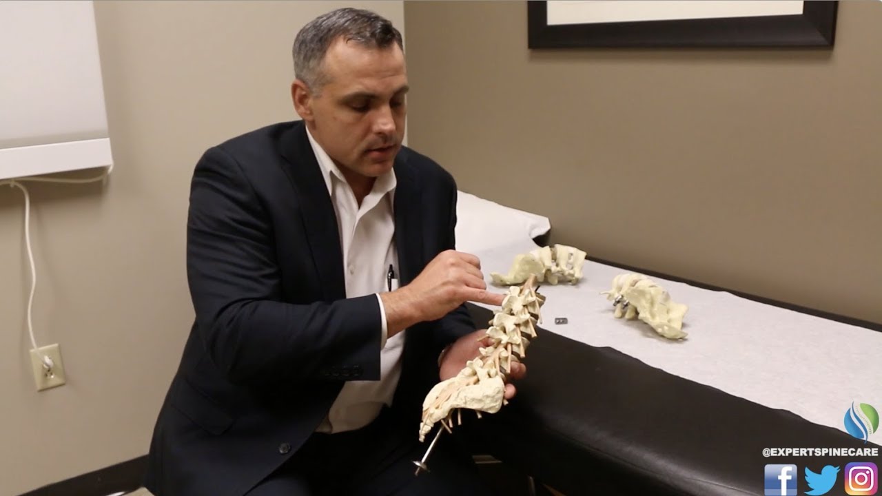 Anatomy of the Spine