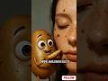 🥔 Potato scrub for soft, glowing skin ✨ Removes tan & dead skin naturally at home 💛🌿 #ytshorts