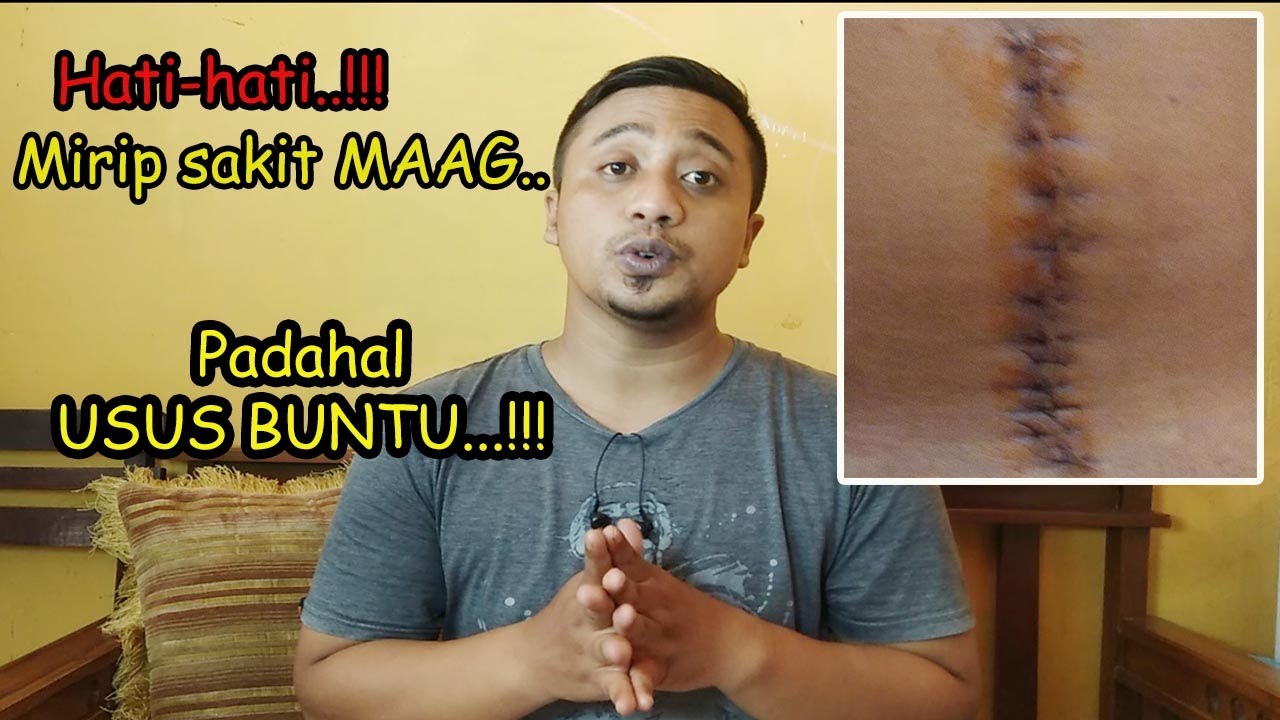PENGALAMAN OPERASI USUS BUNTU