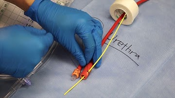 Ureteral Stenting for Pelvic Surgeons