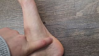 Heel spur treatment