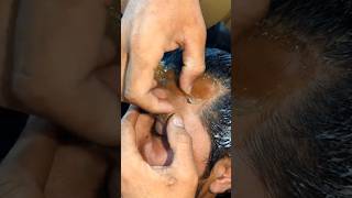 Hair Removing | Beard Style For Men's #hairstyle #beard #shorts