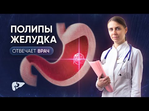 Полипы желудка: причины, диагностика и лечение