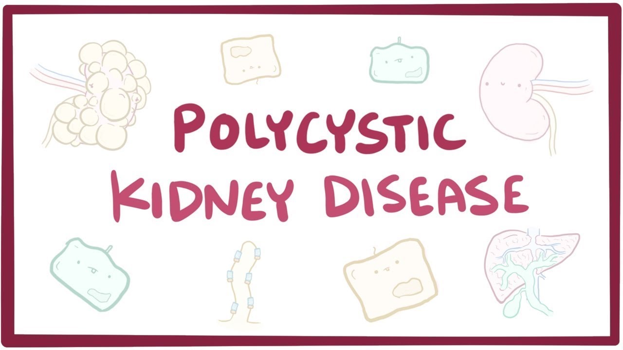 Polycystic kidney disease - an Osmosis preview osmosis 会社