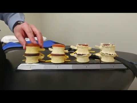 Spinal Decompression Part 3 - Lumbar camera iphone 8 plus apk
