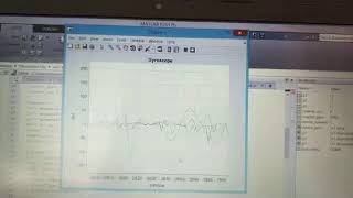 UM6 AHRS - Matlab Real Time Plot
