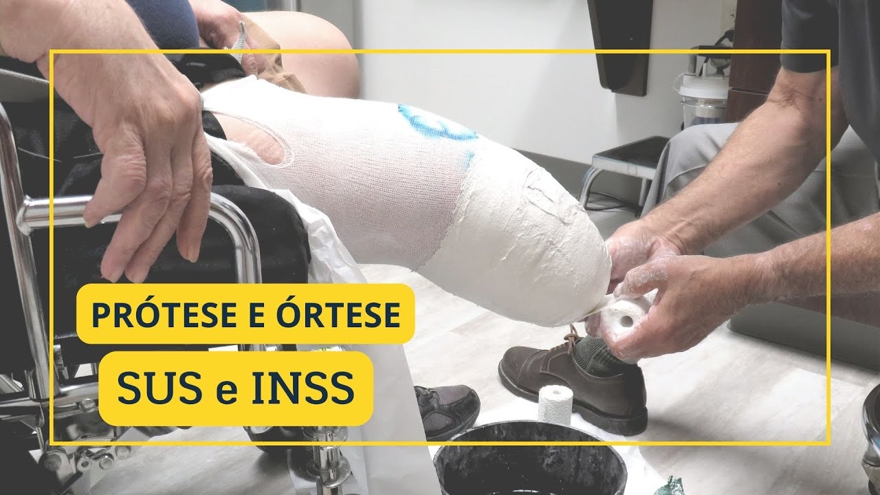 tudo sobre prótese e órtese - pelo INSS e pelo SUS