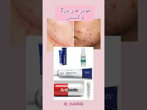 درمان انواع جوش بدن و صورت