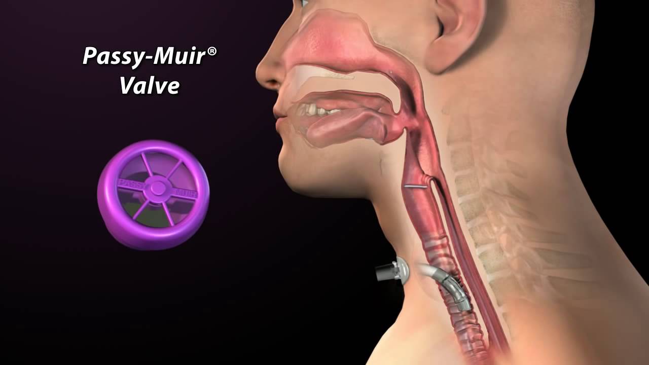 Speaking valve for ventilator