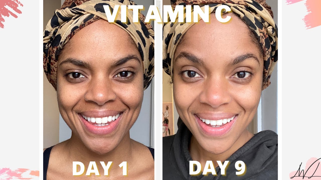 Adding Vitamin C Serum Hyaluronic Acid To My Skincare Routine For 7 Days Clear Glowing Skin Youtube