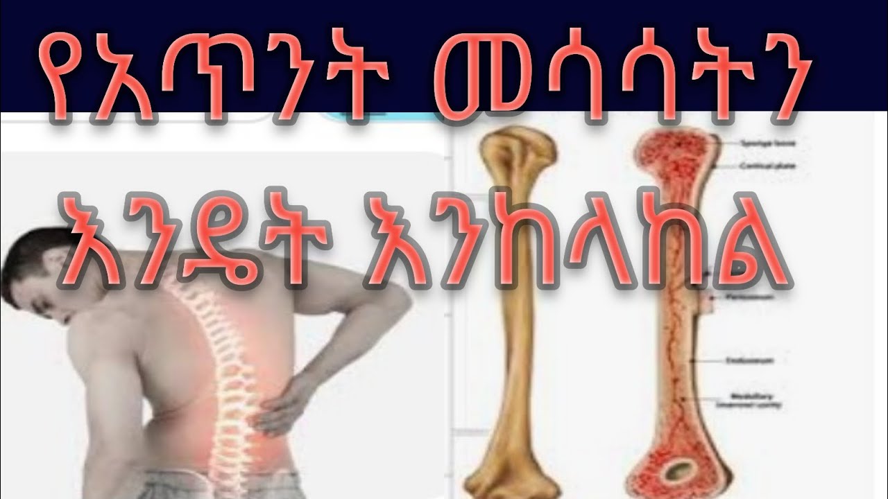How To Prevent Osteoporosis how to prevent osteoporosis