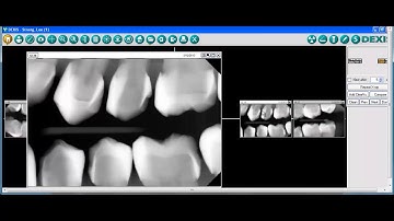QuickRay Compatibilty - DEXIS