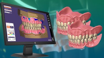 The Workflows for A Patient