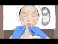 [ASMR] 팅글 1000%💥 여드름 압출과 피부관리를 한번에! / Acne extract / makeup animation