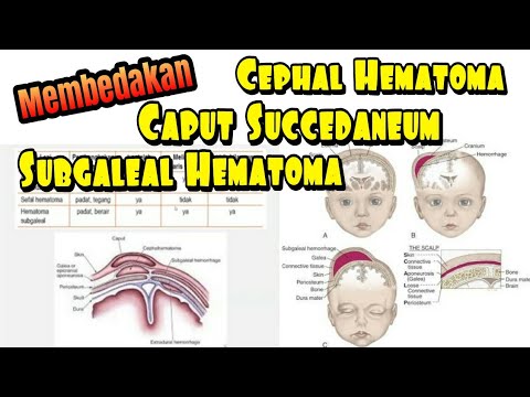 Video: Adakah hematoma keras atau lembut?