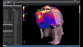 Sim4Life V6.0 Neural Sensing Package: Simulation of Neural Activity in a Branching Peripheral Nerve