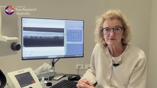 Australian scientists reveal new genetic risk for severe macular degeneration
