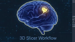 Brain Tumor Editing in 3D Slicer | Step-by-Step Medical Imaging Tutorial