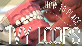 How to Place Ivy Loops