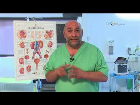 Video: Pietre la rinichi la femei - simptome și tratament