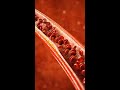Hypertension: The Silent Killer