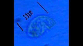 Colpoda steinii Guide
