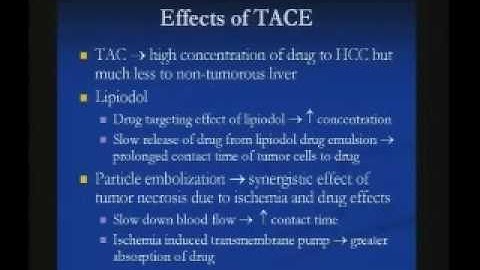Transarterial Chemoembolization TACE for Hepatocellular Carc