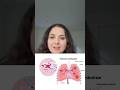 Pulmonary embolism is an important topic in Respiratory System while you prepare for NCLEX EXAM.