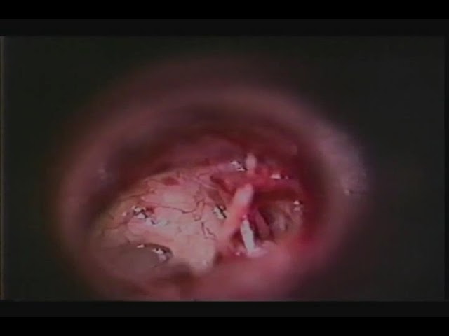 youtube-video-thumbnail