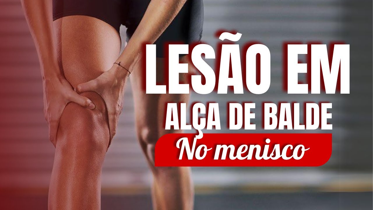 Lesão De Alça De Balde No Menisco Descubra Os Tratamentos Eficazes 